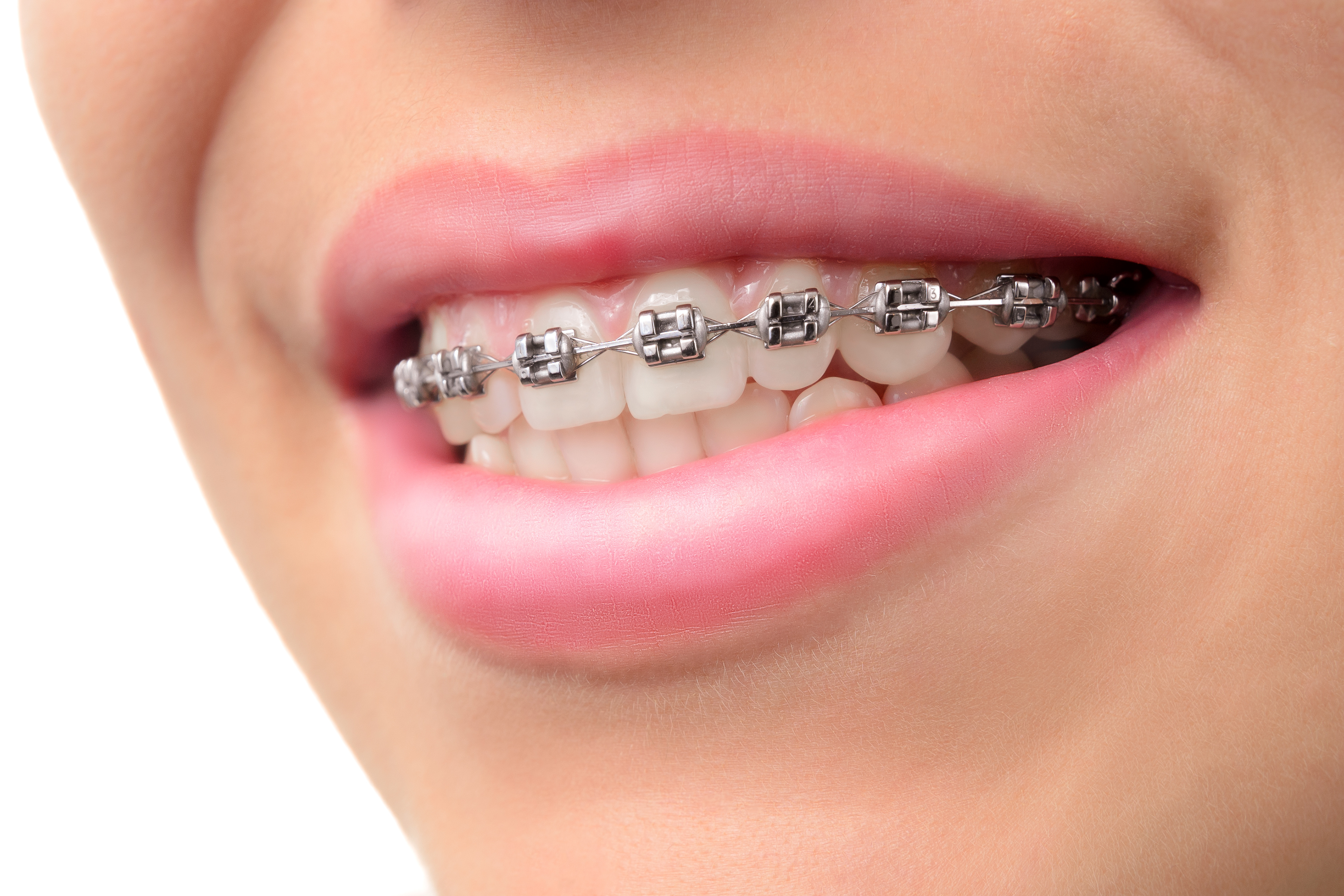 Dentist | Braces | Implants | Holbrook | Joseph City | Winslow Dental