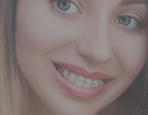 Braces at Winslow Dental, Top Cosmetic Dentist, Located in Winslow, AZ