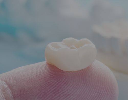 Crowns at Winslow Dental, Top Cosmetic Dentist, Located in Winslow, AZ