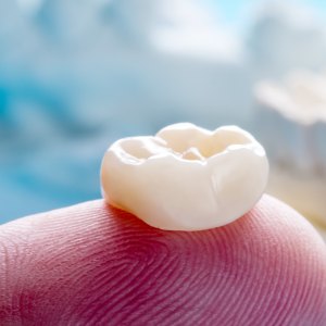 Crowns at Winslow Dental Near Me in Winslow, AZ