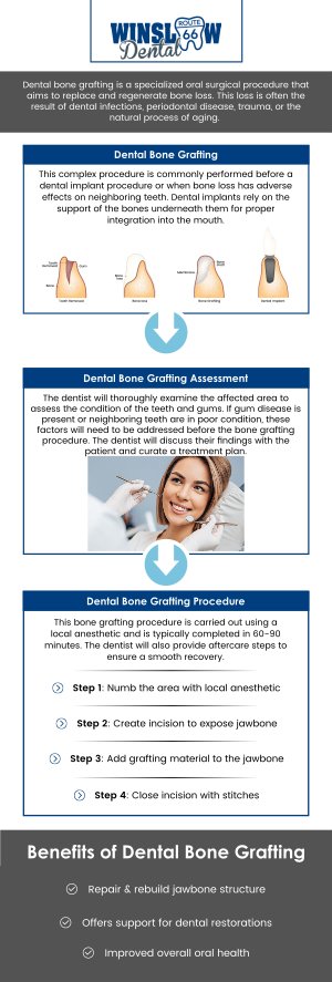 Common questions asked by patients: What is a dental bone graft? What conditions are managed with a dental bone graft? What happens during a dental bone grafting procedure? What are the potential benefits of a dental bone graft? How long does a dental bone graft last? At Winslow Dental, Dr. Brent J. Gardner, DDS, offers dental bone grafting to restore jawbone loss and prepare patients for dental implants. Using advanced techniques, Dr. Gardner ensures a comfortable procedure and a strong foundation for lasting implants. For more information, contact us or schedule an appointment online. We are conveniently located at 321 W 2nd St, Winslow, AZ 86047. We serve patients from Winslow AZ, West Winslow AZ, Joseph City AZ, Leupp AZ, Holbrook AZ and surrounding areas. Common questions asked by patients: What is a dental bone graft? What conditions are managed with a dental bone graft? What happens during a dental bone grafting procedure? What are the potential benefits of a dental bone graft? How long does a dental bone graft last?
At Winslow Dental, Dr. Brent J. Gardner, DDS, offers dental bone grafting to restore jawbone loss and prepare patients for dental implants. Using advanced techniques, Dr. Gardner ensures a comfortable procedure and a strong foundation for lasting implants. For more information, contact us or schedule an appointment online. We are conveniently located at 321 W 2nd St, Winslow, AZ 86047. We serve patients from Winslow AZ, West Winslow AZ, Joseph City AZ, Leupp AZ, Holbrook AZ and surrounding areas.