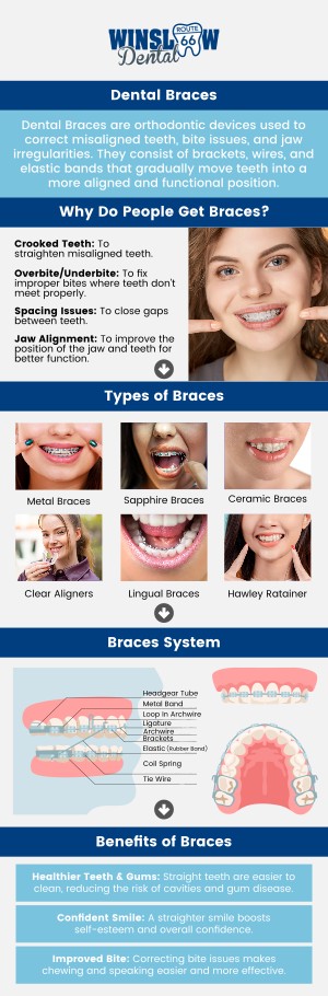 Looking for Dental Braces Near Me? Visit Winslow Dental, where Dr. Brent J. Gardner, DDS, provides customized braces treatment tailored to each patient’s unique needs for lasting results. Dental braces are orthodontic devices used to straighten misaligned teeth and correct bite issues, helping you achieve a healthier and more attractive smile. They are recommended for children, teens, and adults with crooked teeth, gaps, or bite problems that affect chewing, speaking, or overall oral health. The benefits of braces include improved function, enhanced appearance, easier cleaning, and long-term protection for your teeth and jaw.. For more information, contact us or schedule an appointment online. We are conveniently located at 321 W 2nd St, Winslow, AZ 86047.