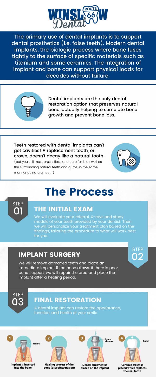 Dental implants at Winslow Dental, provided by Dr. Brent J. Gardner, DDS, offer a permanent and natural-looking solution for missing teeth. Each implant is carefully placed to restore function, protect jawbone health, and enhance your smile’s appearance. With advanced techniques and personalized care, dental implants in Winslow, AZ, provide long-term stability and confidence, allowing you to eat, speak, and smile with ease. For more information, contact us or schedule an appointment online. We are conveniently located at 321 W 2nd St, Winslow, AZ 86047.