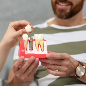 Implants at Winslow Dental Near Me in Winslow, AZ