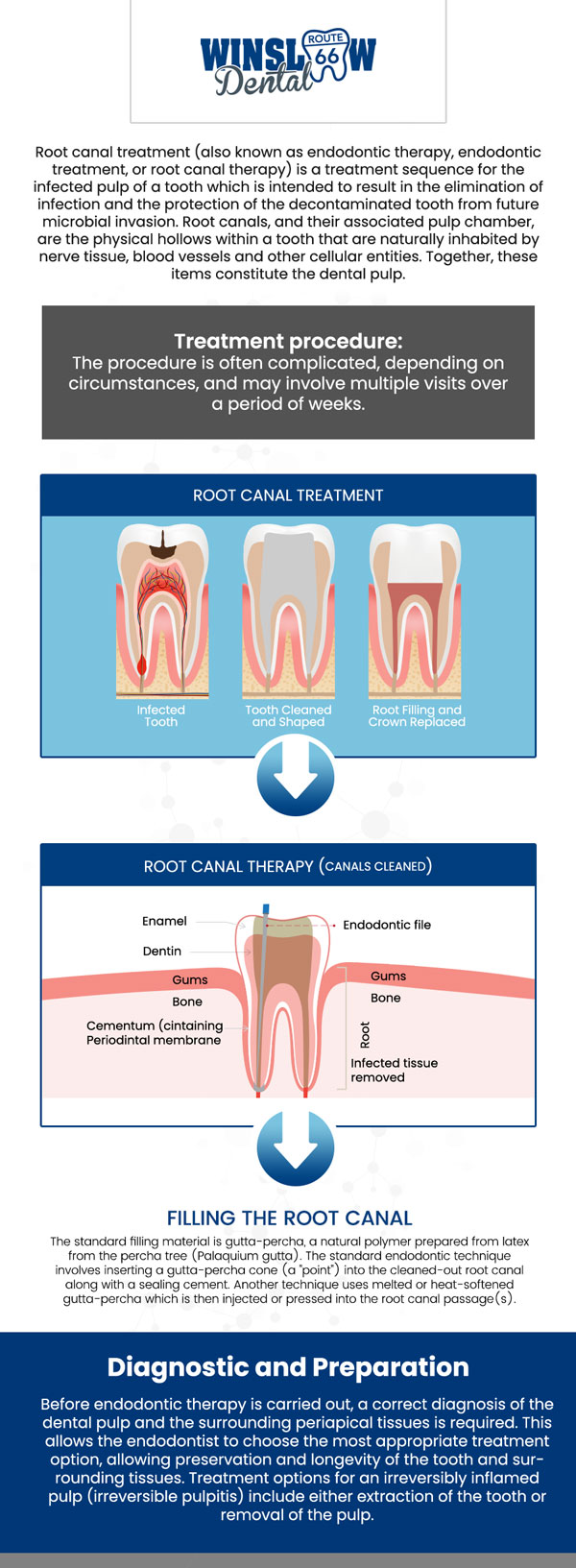 Looking for Root Canal Treatment Near Me? At Winslow Dental, Dr. Brent J. Gardner, DDS, provides gentle and effective root canal treatment to save infected or damaged teeth. The procedure removes infection, relieves pain, and restores strength with a filling or crown for lasting protection. Common symptoms that may indicate the need for root canal therapy include severe toothache, pain when chewing, prolonged sensitivity to hot or cold, swelling or tenderness of the gums, and dark discoloration of the tooth. With advanced techniques and personalized care, root canal treatment in Winslow, AZ, helps patients maintain healthy, natural smiles. For more information, contact us or schedule an appointment online. We are conveniently located at 321 W 2nd St, Winslow, AZ 86047. 