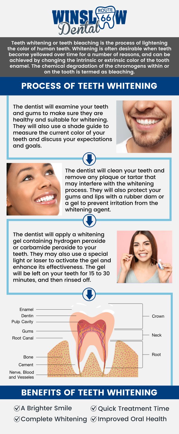 Common questions asked by patients: What is teeth whitening? How does teeth whitening work? Is teeth whitening safe? How long do the results of teeth whitening last? Can teeth whitening work on all types of stains? How much does teeth whitening cost? At Winslow Dental, Dr. Brent J. Gardner, DDS, offers professional teeth whitening treatments to help you achieve a brighter, more confident smile. Using safe and effective whitening methods, we target stubborn stains caused by food, drinks, or aging, leaving your teeth looking fresh and vibrant. For more information, contact us or schedule an appointment online. We are conveniently located at 321 W 2nd St, Winslow, AZ 86047. We serve patients from Winslow AZ, West Winslow AZ, Joseph City AZ, Leupp AZ, Holbrook AZ and surrounding areas. Common questions asked by patients: What is teeth whitening? How does teeth whitening work? Is teeth whitening safe? How long do the results of teeth whitening last? Can teeth whitening work on all types of stains? How much does teeth whitening cost? At Winslow Dental, Dr. Brent J. Gardner, DDS, offers professional teeth whitening treatments to help you achieve a brighter, more confident smile. Using safe and effective whitening methods, we target stubborn stains caused by food, drinks, or aging, leaving your teeth looking fresh and vibrant. For more information, contact us or schedule an appointment online. We are conveniently located at 321 W 2nd St, Winslow, AZ 86047. We serve patients from Winslow AZ, West Winslow AZ, Joseph City AZ, Leupp AZ, Holbrook AZ and surrounding areas.
