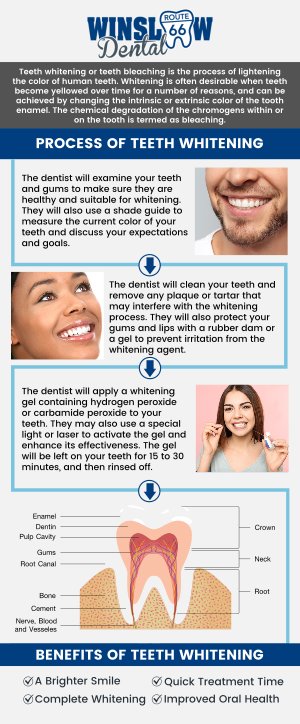 Common questions asked by patients: What is teeth whitening? How does teeth whitening work? Is teeth whitening safe? How long do the results of teeth whitening last? Can teeth whitening work on all types of stains? How much does teeth whitening cost? At Winslow Dental, Dr. Brent J. Gardner, DDS, offers professional teeth whitening treatments to help you achieve a brighter, more confident smile. Using safe and effective whitening methods, we target stubborn stains caused by food, drinks, or aging, leaving your teeth looking fresh and vibrant. For more information, contact us or schedule an appointment online. We are conveniently located at 321 W 2nd St, Winslow, AZ 86047. We serve patients from Winslow AZ, West Winslow AZ, Joseph City AZ, Leupp AZ, Holbrook AZ and surrounding areas. Common questions asked by patients: What is teeth whitening? How does teeth whitening work? Is teeth whitening safe? How long do the results of teeth whitening last? Can teeth whitening work on all types of stains? How much does teeth whitening cost? At Winslow Dental, Dr. Brent J. Gardner, DDS, offers professional teeth whitening treatments to help you achieve a brighter, more confident smile. Using safe and effective whitening methods, we target stubborn stains caused by food, drinks, or aging, leaving your teeth looking fresh and vibrant. For more information, contact us or schedule an appointment online. We are conveniently located at 321 W 2nd St, Winslow, AZ 86047. We serve patients from Winslow AZ, West Winslow AZ, Joseph City AZ, Leupp AZ, Holbrook AZ and surrounding areas.